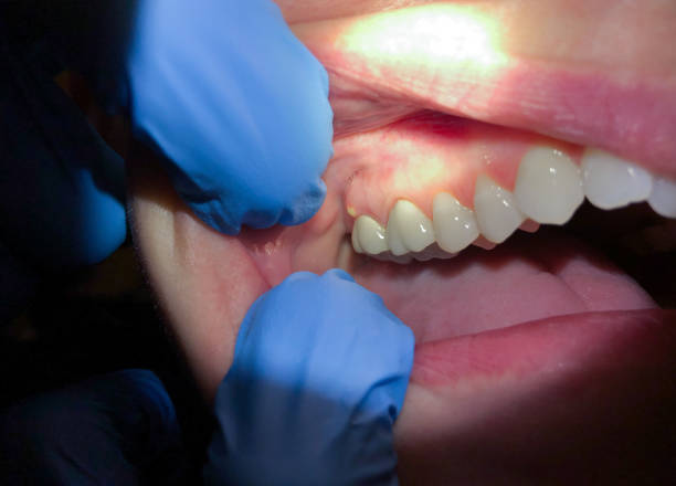Best Emergency Dental Care for Trauma or Injury in Moodus, CT